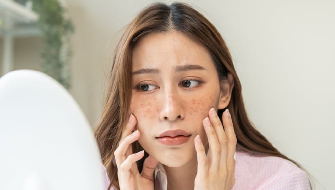 Woman determining if her skin is purging or breaking out.