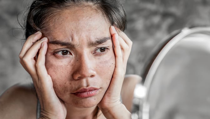 Woman with stressed skin