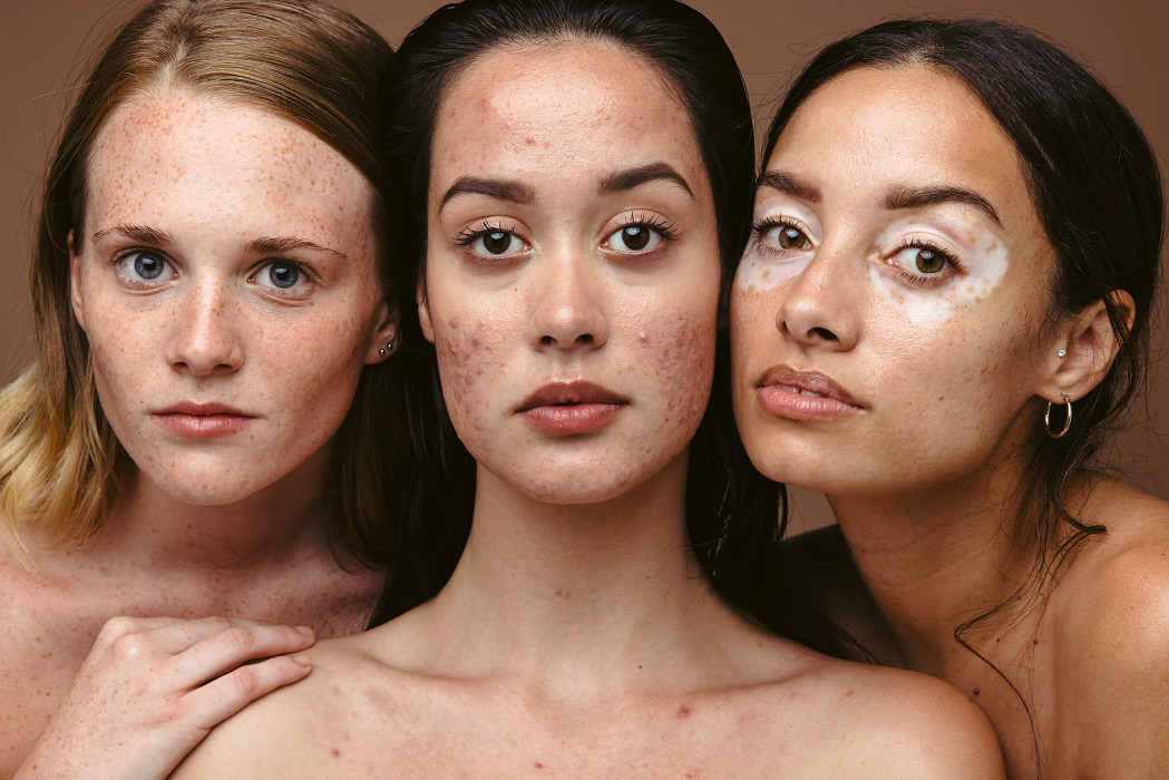 Normalize-Real-Skin-Blog