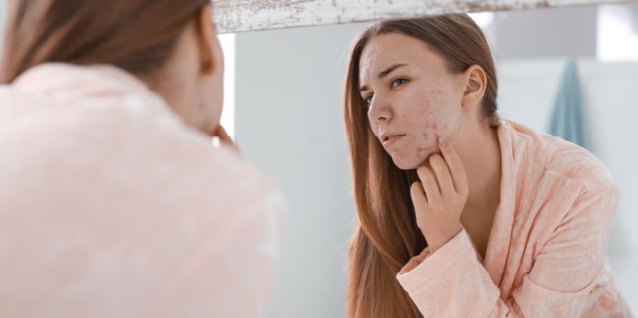 Woman examining her skin to see if it is purging or breaking out from using new professional skin care product.