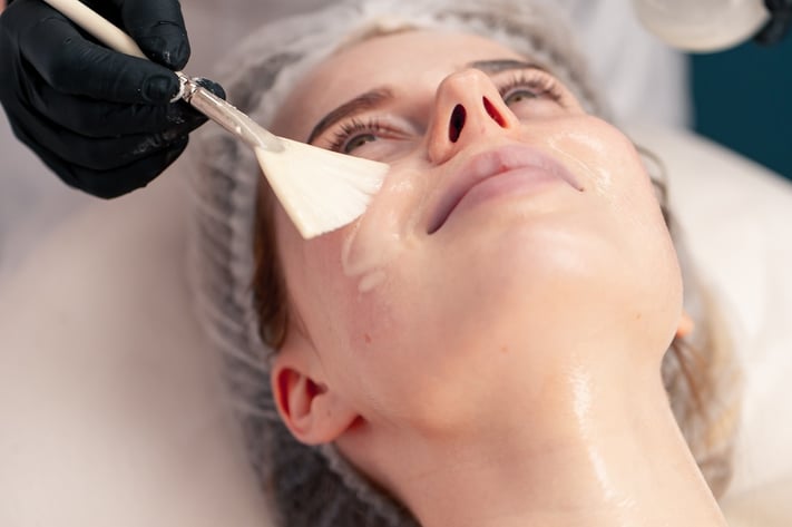 Woman getting chemical peel