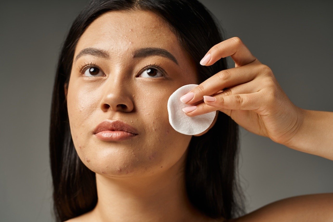 woman removing makeup to remove pore clogging residue