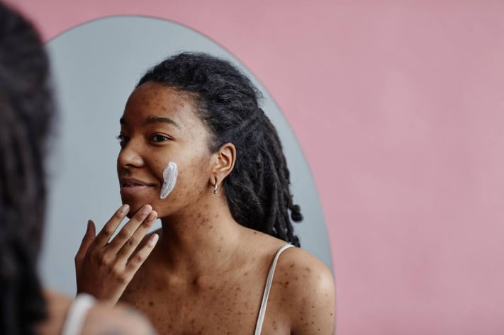 woman using skincare to treat acne