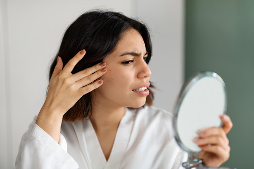Woman suffering from acne and checking skin in mirror